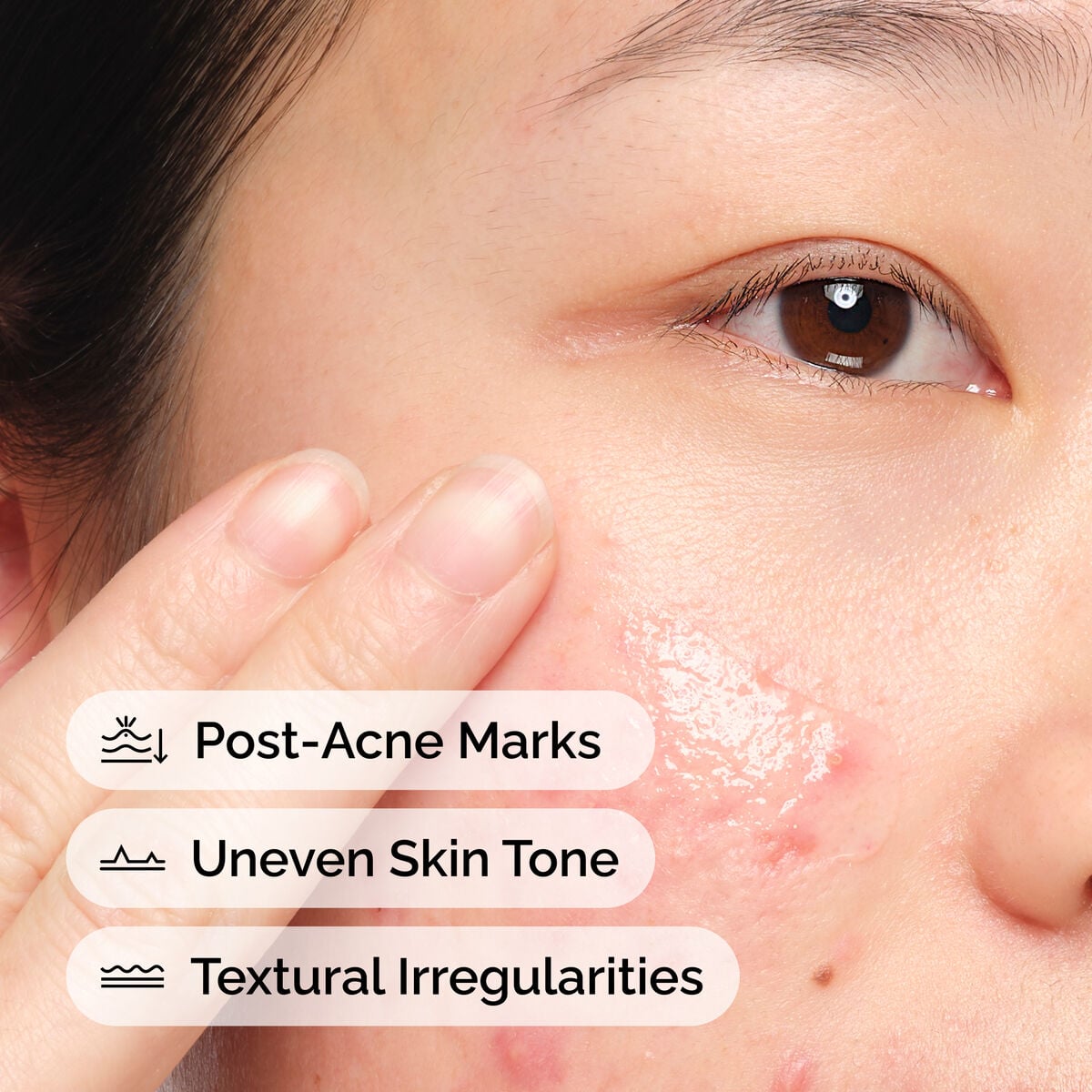 Aloe + NAG Solution Daily Treatment Ritual Z8