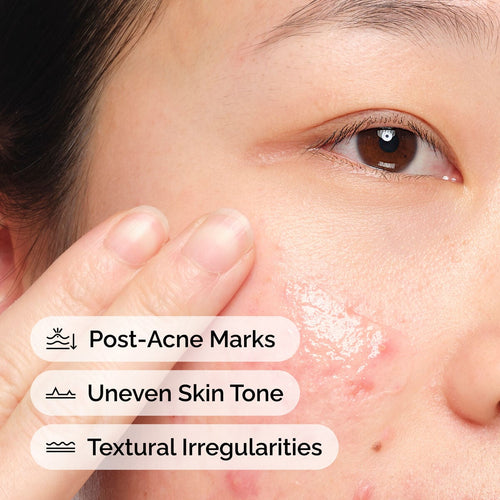 Aloe + NAG Solution Daily Treatment Ritual Z8
