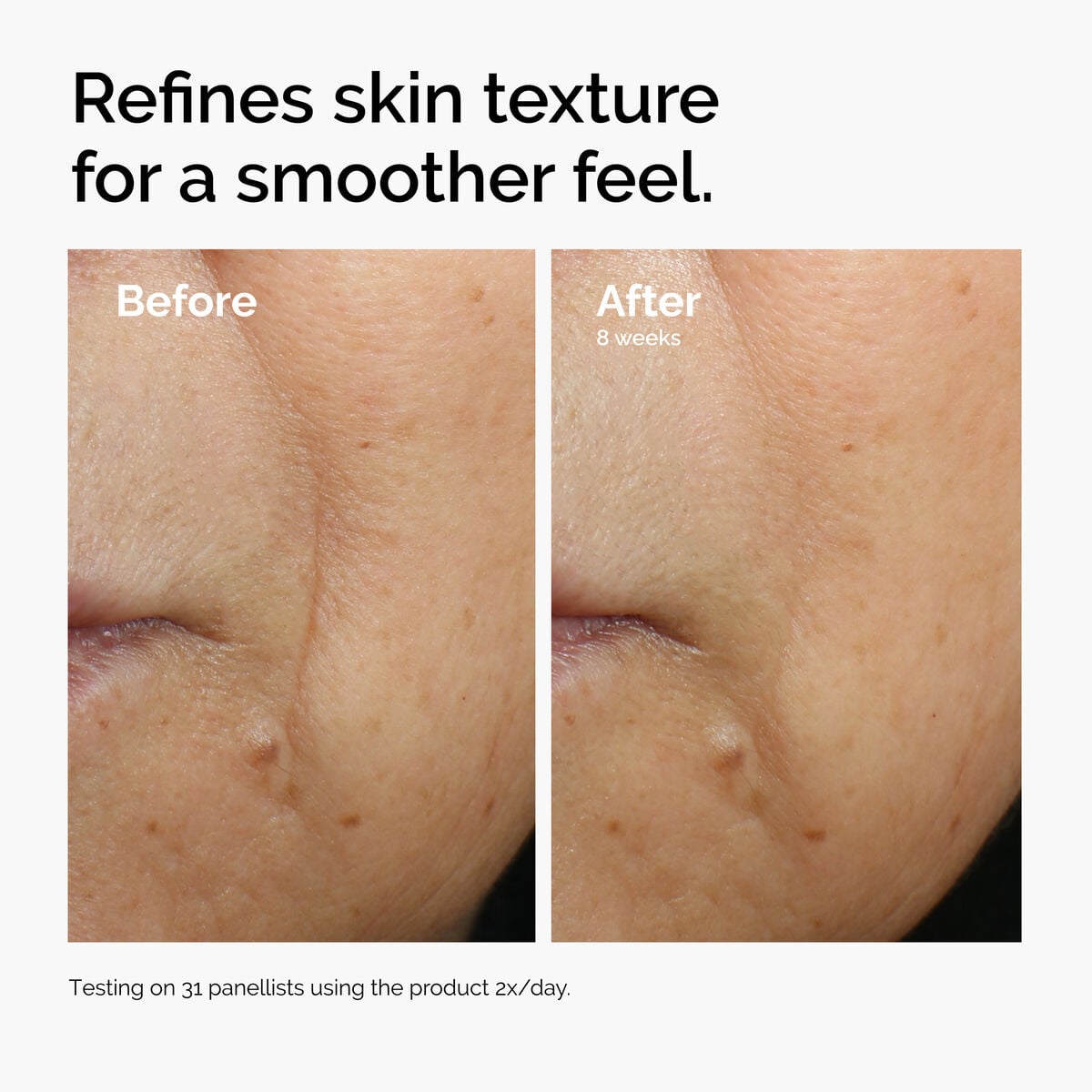 Caffeine + Escin Face Serum Targeted Serum Care Z4