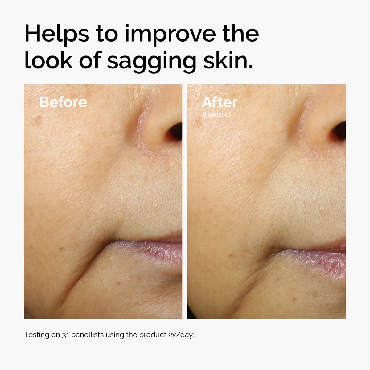 Caffeine + Escin Face Serum Targeted Serum Care Z4