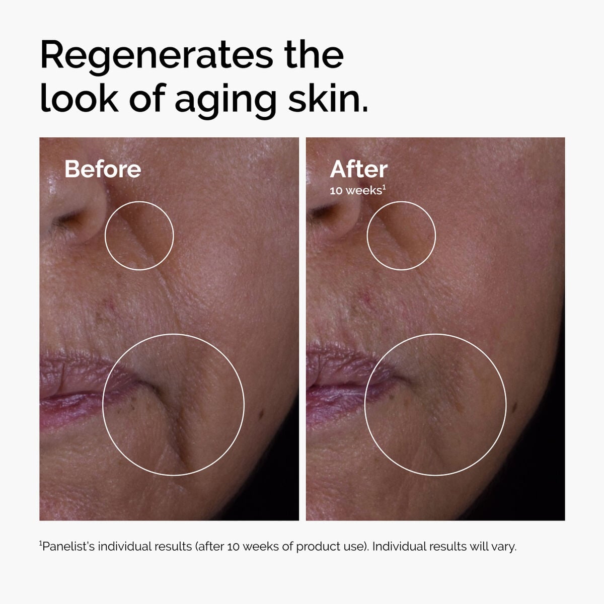 GF Solution Targeted Serum Care Z6