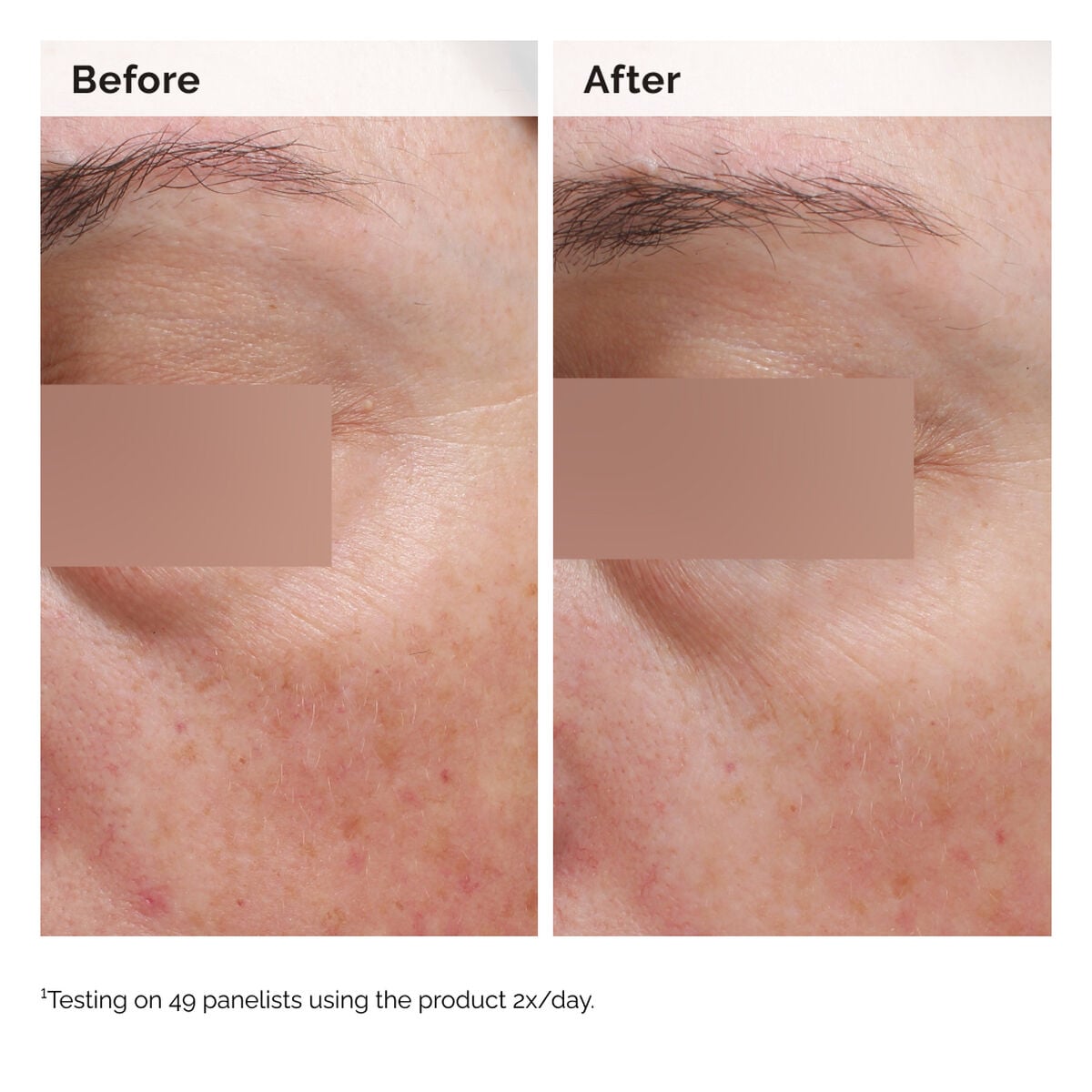 Niacinamide Face and Body Emulsion Targeted Serum Care J8