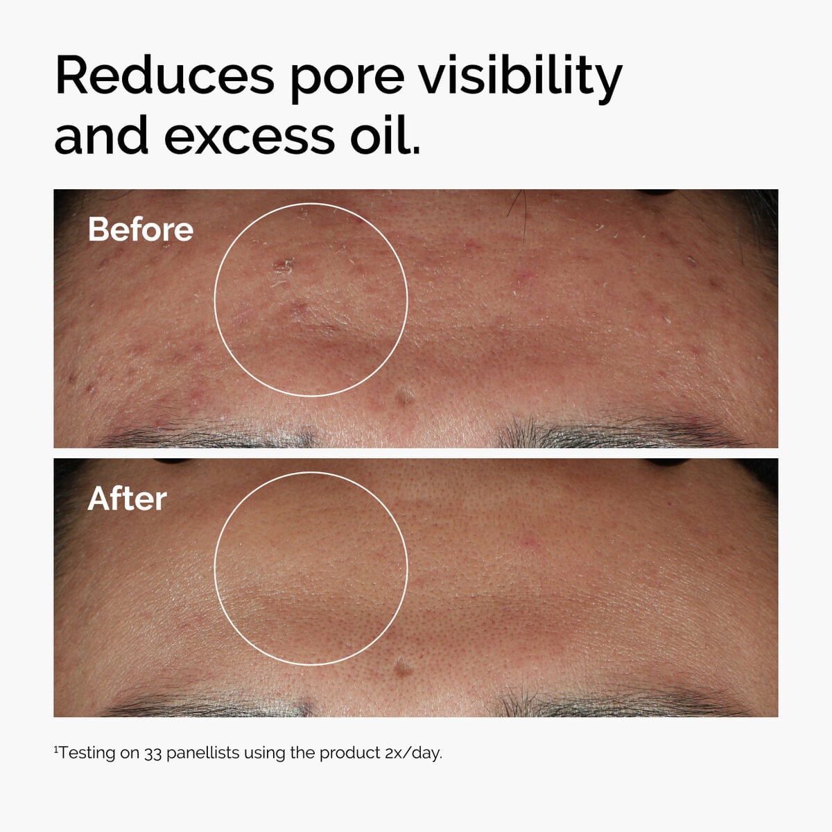 Niacinamide + Zinc Targeted Serum Care Y6