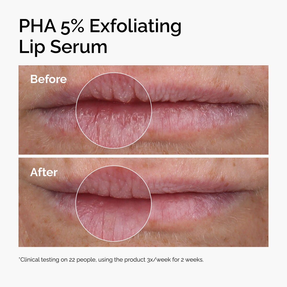 PHA Exfoliating Lip Serum Targeted Serum Care A8