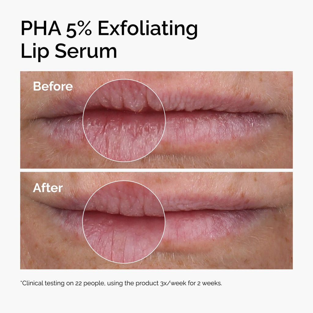 PHA Exfoliating Lip Serum Targeted Serum Care P8
