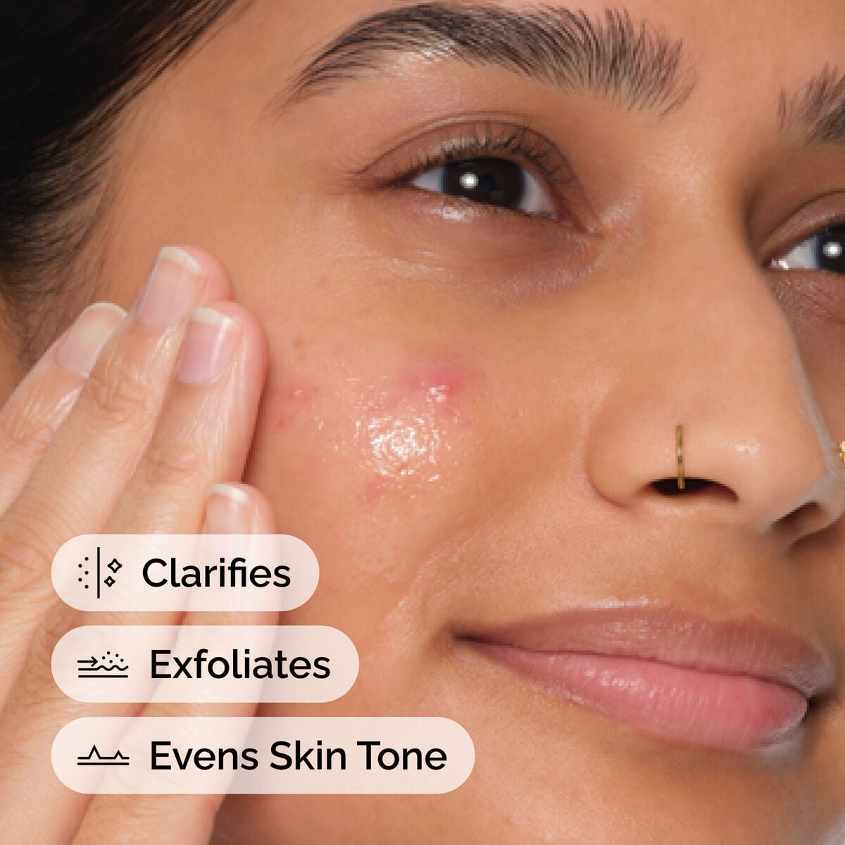 Salicylic Acid Anhydrous Solution Targeted Serum Care Q3
