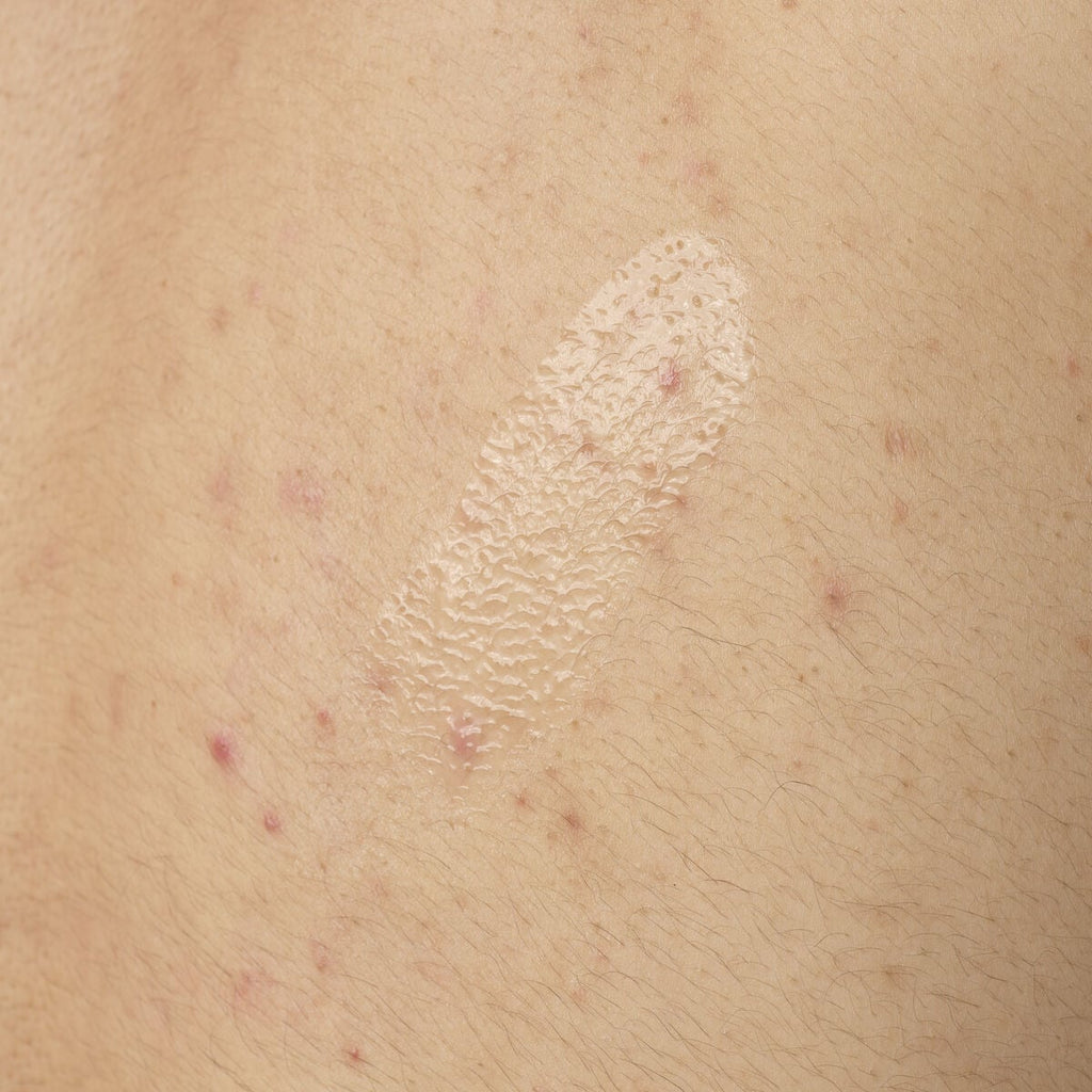 Salicylic Acid Body Serum Targeted Serum Care R0