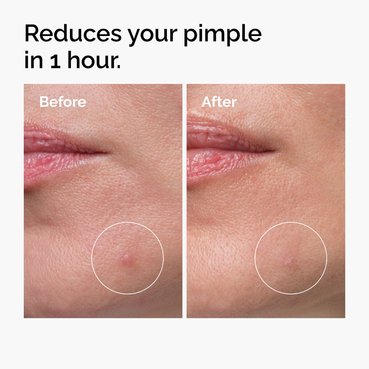 Sulfur Powder-to-Cream Concentrate Targeted Serum Care V9